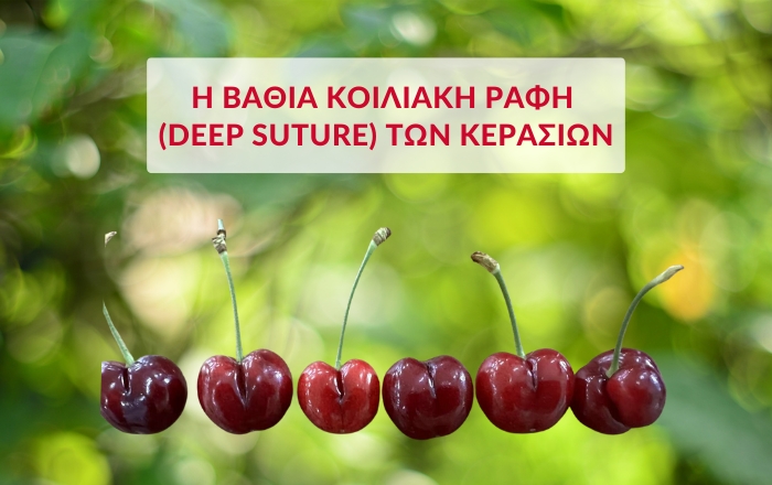 Η βαθιά κοιλιακή ραφή (deep suture) των κερασιών